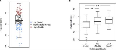 High hypoxia status in pancreatic cancer is associated with multiple hallmarks of an immunosuppressive tumor microenvironment